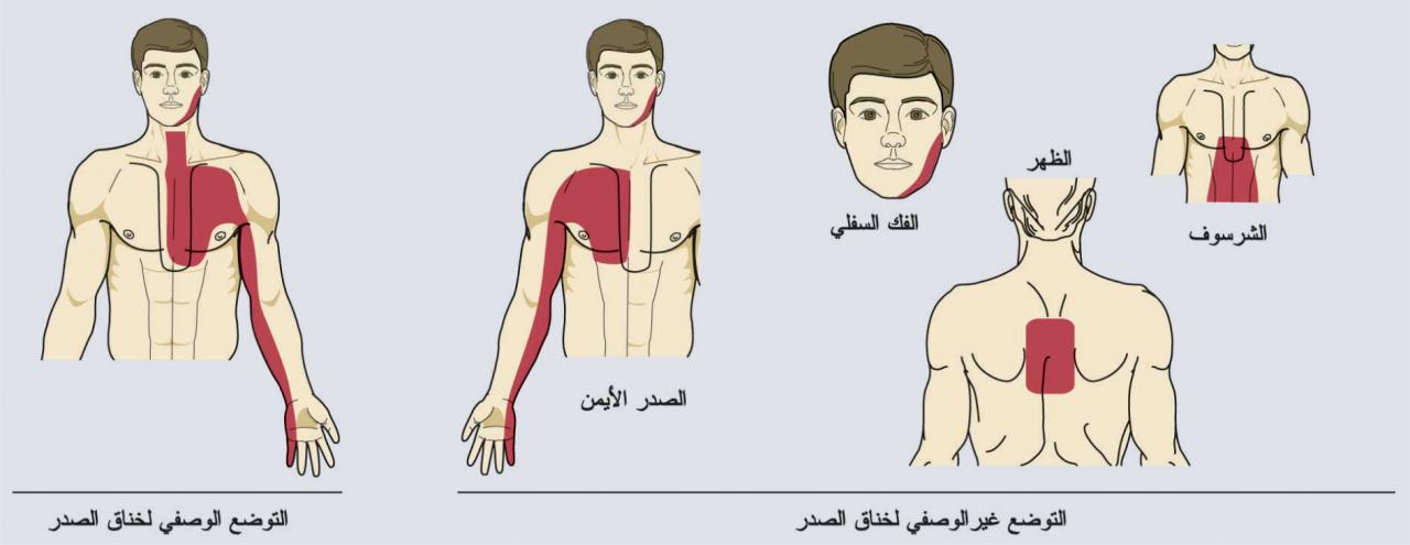 الم مكان القلب - ما سبب الشعور بالالم في القلب 3551 2