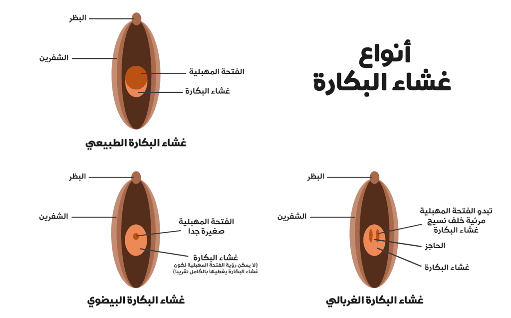 الفرق بين العذراء والغير عذراء بالصور - كيف اعرف اني بنت 3501 2