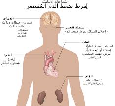 كيف انزل الضغط , اسرع علاج لخفض ضغط الدم