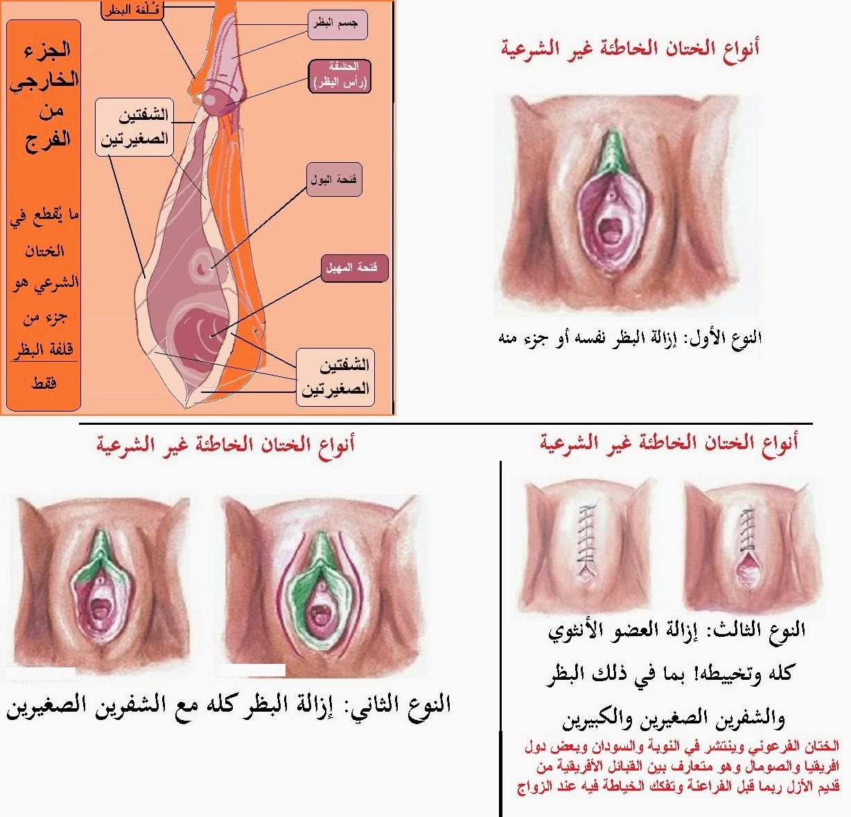 حبه جنب فتحة المهبل - حبوب بغدد بارثولين الاعراض والعلاج 2716 1