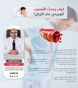 اسباب التسرب الوريدى , أفضل طرق علاج التسرب الوريدى