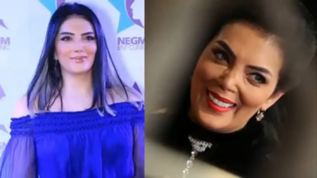 حورية فرغلي بعد التجميل , نجوم الفن المصري بعد التجميل