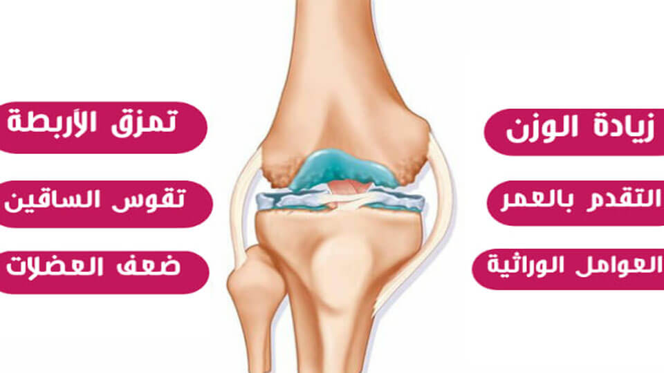 علاج مفصل الركبة , لارتخاء العضلات