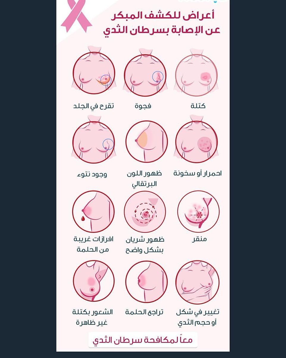 اعراض مرض سرطان الثدي بالصور - علامات تظهر مرض سرطان 2161 2