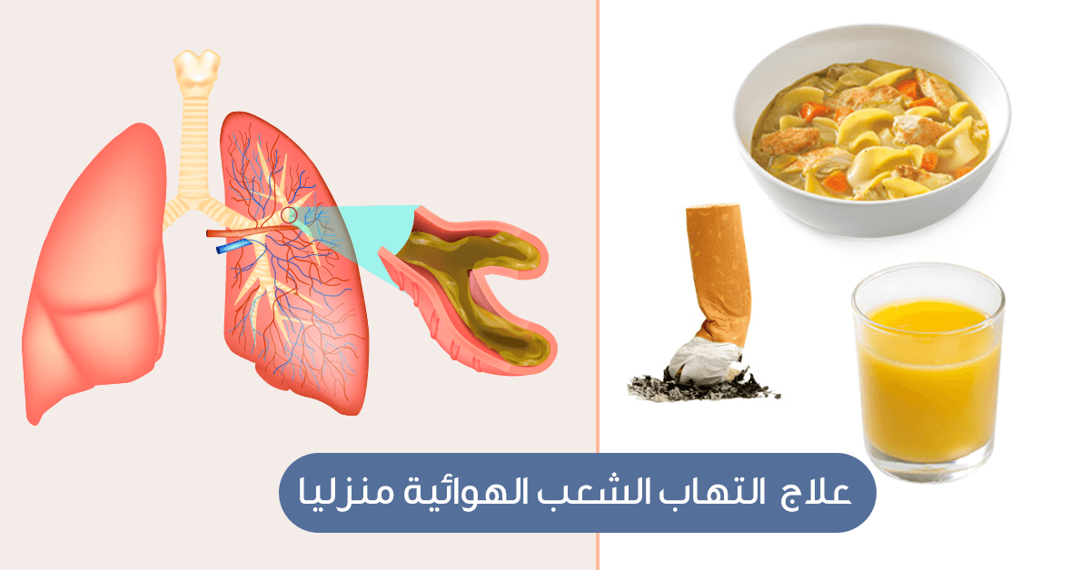 علاج التهاب الشعب الهوائية - تعرف على العلاج المفيد للالتهاب الشعب الهوائيه